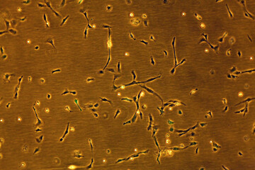 Adherent cells in culture transfected with a Green Fluorescent Protein (GFP)producing plasmid -...