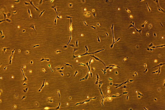 Adherent cells in culture transfected with a Green Fluorescent Protein (GFP)producing plasmid - view under visible light and fluorescent light