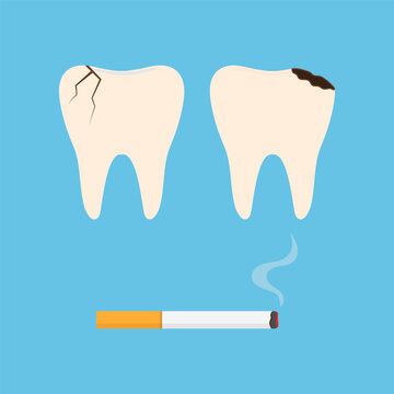 Dangers of smoking concept. Unhealthy teeth and cigarette vector flat illustration.