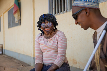 Close-up of a young face burnt African girl sitting, listening to her blind male friend