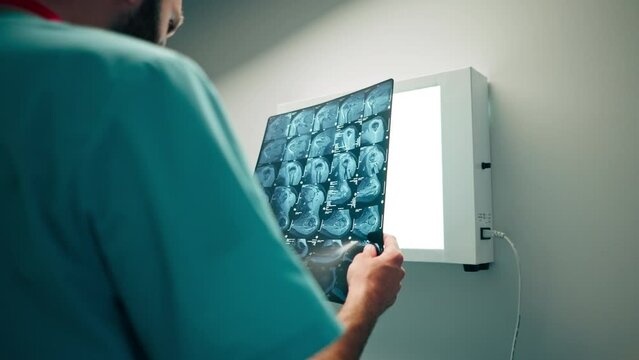 Close-up shot a radiologist carefully examines the MRI image on special board and describes what he saw