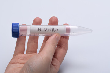 In vitro, fiolka probówka trzymana w dłoni w laboratorium  - obrazy, fototapety, plakaty