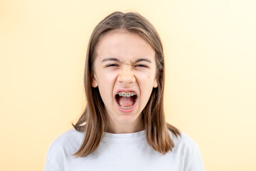 A teenage girl with braces screams with her mouth wide open.