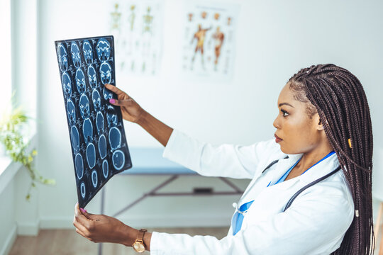 Doctor reviewing x-ray. A female doctor or surgeon is analysing the digitally generated scans of a human brain. Brain X ray image. Female doctor looking at x-ray image scan of a brain.