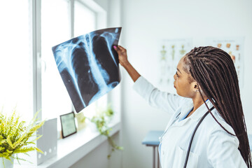 Female doctor in hospital holding patient x-ray film, radiologist studying radiography result,...