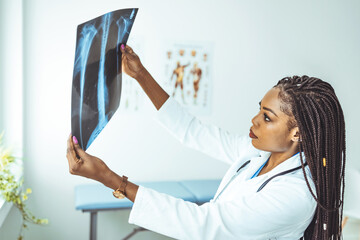 Nurse examining chest x-rays in hospital. Young serious female radiologist in whitecoat pointing at...