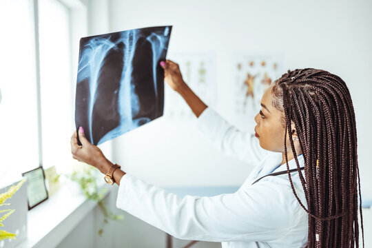 Nurse examining chest x-rays in hospital. Young serious female radiologist in whitecoat pointing at x-ray image of patient lungs while sitting against workplace with computer monitor