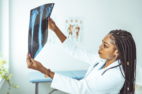 Nurse examining chest x-rays in hospital. Young serious female radiologist in whitecoat pointing at x-ray image of patient lungs while sitting against workplace with computer monitor