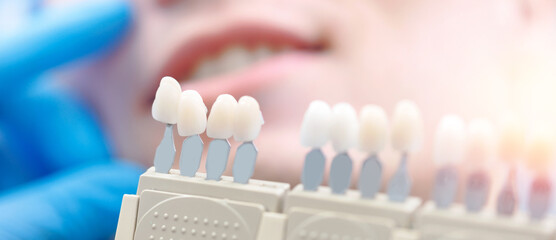 Banner dentistry, Selection of correct tooth color for professional cosmetic whitening bleaching at dental cabinet.