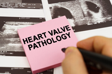 On the ultrasound pictures there are stickers that say - heart valve pathology