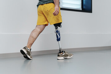 Unrecognisable male in yellow coloured shorts wearing prosthetic leg walking in luminous spacious...