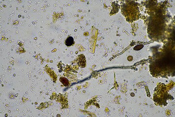 soil microorganism under the microscope recycling nutrients in a compost on a regenerative...