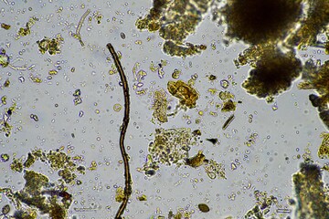 soil microorganism under the microscope recycling nutrients in a compost on a regenerative...