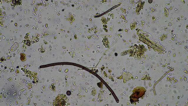 soil microorganisms under the microscope, including, fungi hyphae