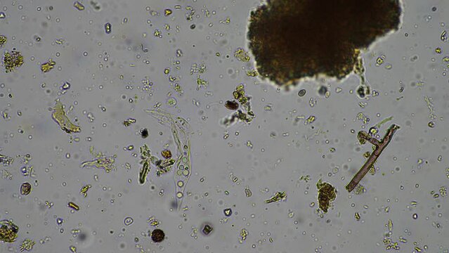 soil microorganisms under the microscope, including, fungi hyphae