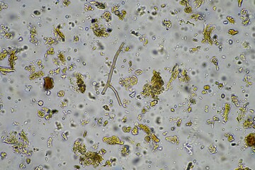soil microorganism under the microscope recycling nutrients in a compost on a regenerative...