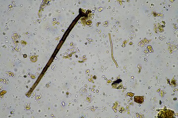 soil microorganism under the microscope recycling nutrients in a compost on a regenerative...