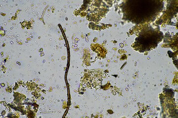 soil microorganism under the microscope recycling nutrients in a compost on a regenerative...