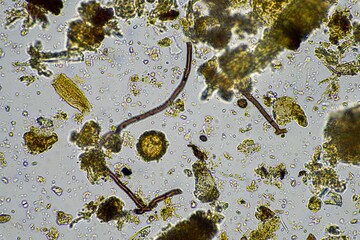 soil microorganism under the microscope recycling nutrients in a compost on a regenerative...