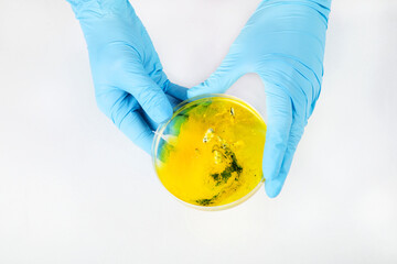 Hand in blue glove holding  petri dish with bacterium . Microbiology sience