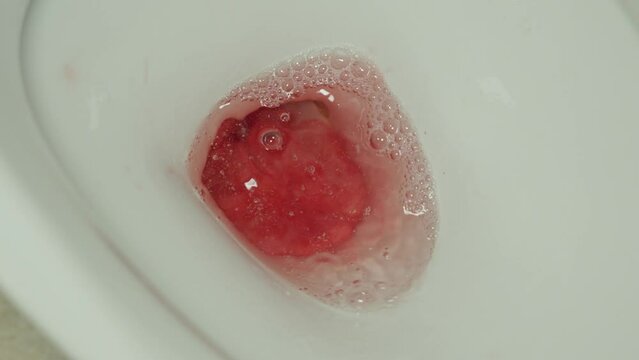 Bloody urine hitting toilet bowl, close up