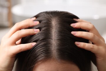 Woman examining her hair and scalp on blurred background, closeup - obrazy, fototapety, plakaty