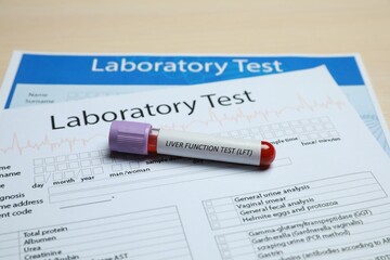 Liver Function Test. Tube with blood sample and laboratory forms on table