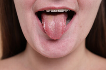 Closeup view of woman showing her tongue