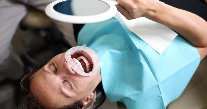 Woman visits dental clinic and looks at reflection of smile after treatment. Veneer installation and beautiful smile
