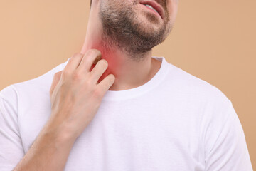 Obraz premium Allergy symptom. Man scratching his neck on light brown background, closeup