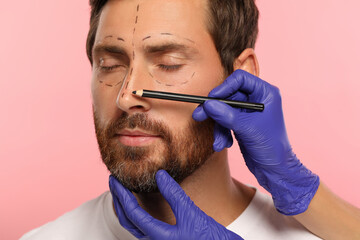 Doctor with pencil preparing patient for cosmetic surgery operation on pink background, closeup