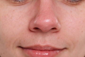 Closeup view of woman with blackheads on her nose - obrazy, fototapety, plakaty