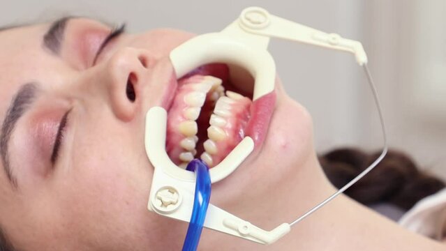 Close up of young woman with ligature braces on teeth suffering from pain. White background. Concept of orthodontic treatment and dentistry