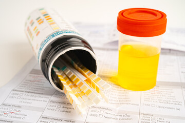 Urinalysis, urine cup with reagent strip pH paper test and comparison chart in laboratory.