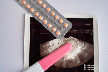 Pregnancy test and birth control pills with ultrasound scan of baby uterus, contraception health and medicine. - obrazy, fototapety, plakaty