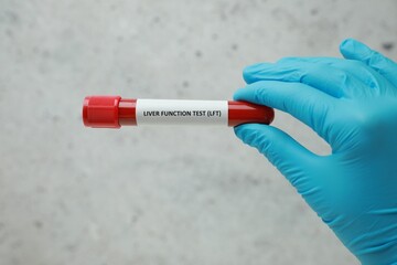 Laboratory worker holding tube with blood sample and label Liver Function Test against light...