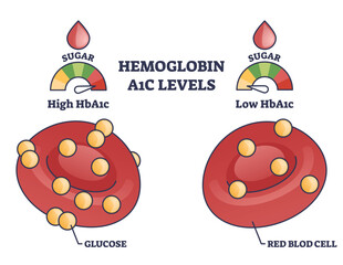 Hemoglobin A1C test levels with red blood cell and glucose outline diagram. Labeled educational scheme with diabetes or prediabetes checkup principles and low or high results vector illustration - obrazy, fototapety, plakaty
