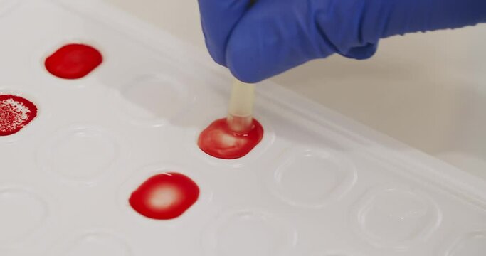 Blood type and rh factor testing by agglutination method. Closeup on doctor hands in medical gloves doing microbiology research in laboratory. Determination blood group