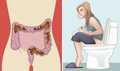 Bowel obstruction. Woman with health problems. Healthcare illustration. Vector illustration.