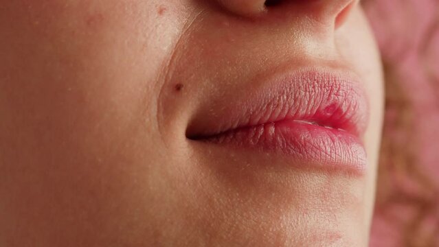 Close-up of young woman plump lips, moles on the face. Pink background. Nature beauty of female face skin