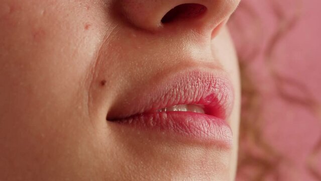 Close-up of young woman plump lips, moles on the face. Pink background. Nature beauty of female face skin