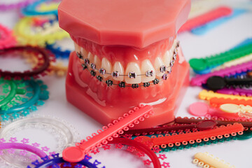 Orthodontic ligatures rings and ties, elastic rubber bands on orthodontic braces, model for dentist studying about dentistry.