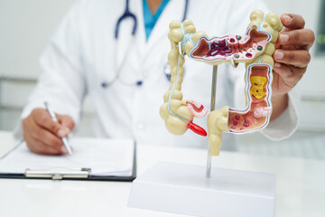 Intestine, doctor holding anatomy model for study diagnosis and treatment in hospital.