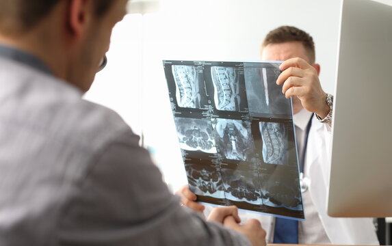Doctor hold xray bone spine radiography in hand. Examination and treatment of intervertebral hernia. Traumatology tomography hospital radiographer concept.