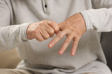 Senior man suffering from pain in hand, closeup. Rheumatism symptom