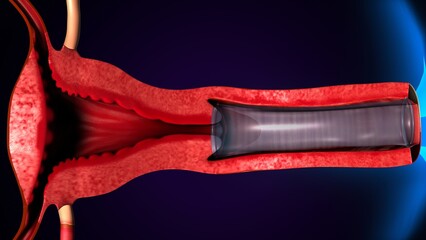 female reproductive,ovary and vagina system anatomy. 3d illustration - obrazy, fototapety, plakaty