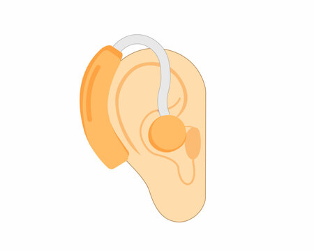 Ear cochlear implant device vector illustration of hearing on ear