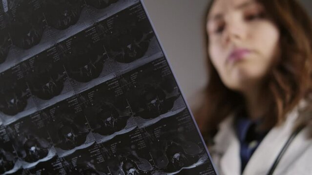 A female doctor in a white coat holds an unrecognizable X-ray of the bones of the spine. The camera is moving towards the model. Medicine and treatment of protrusion and fractures