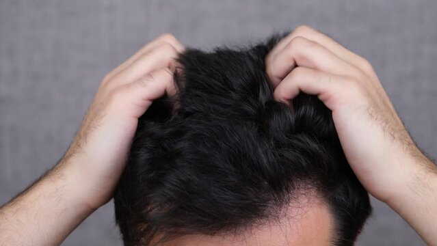 man itching straching head