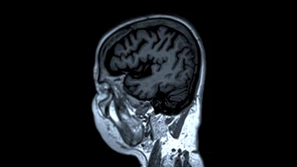 Fotobehang MRI brain scans sagittal view offer valuable insights into brain © samunella